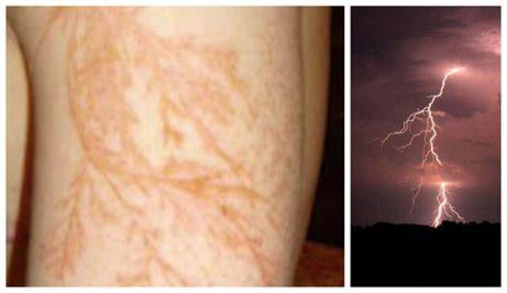 Lightning Strike Effects