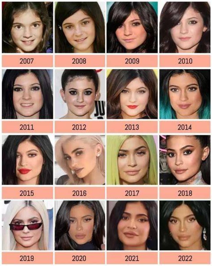 Plastic Surgery?Watch Kylie Jenner’s Entire Body Transform Over Time