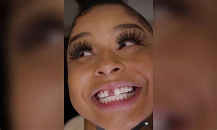 What Happened To Chrisean Rock's Tooth?